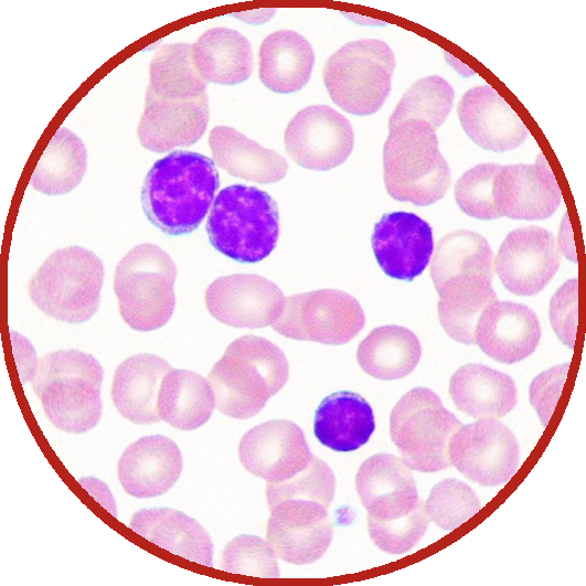 Oncohematology